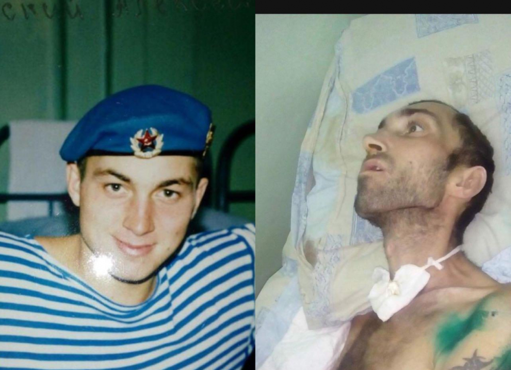 На Кубани ветерана чеченской войны после ДТП отправили в хоспис умирать