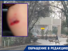 Бездомная собака вырвала кусок кожи у прохожей в Краснодаре 