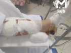 ДТП с пострадавшей школьницей в Краснодаре привлекло внимание омбудсмена России 