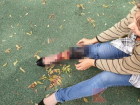 Собаки напали на врача и искусали 9-летнюю девочку на Кубани