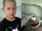 На кузнеца, по вине которого пострадал ребенок-инвалид на празднике в Краснодаре, завели уголовное дело