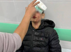 Ржавые качели разбили голову подростку в Краснодарском крае 