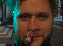 Вокалисту группы «Бакс Бани» во время выступления в Геленджике слушатель сломал нос