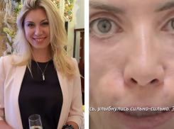 Изуродованная модель рассказала, сколько стоила операция у краснодарских хирургов