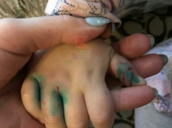 Кролики Краснодара до крови покусали маленькую девочку