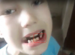  Настоящий хоккеист вырвал зуб ударом по шайбе в Краснодаре 