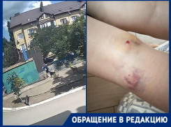 «Страшно ходить во дворе»: стая собак нападает на детей в поселке Краснодара
