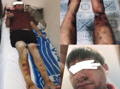 «Вытащили за ноги»: в Сочи мужчина обвинил гаишников в избиении