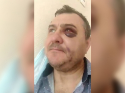 Экс-солисту группы «Лесоповал» после концерта в Сочи сломали челюсть