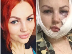 Поход в караоке для жительницы Апшеронска закончился сотрясением головного мозга и порезами на лице