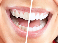  Как часто нужно посещать стоматолога краснодарцам? 