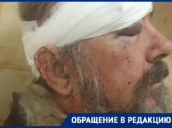 За отказ надеть маску кубанский полицейский сломал инвалиду руку и рассек бровь 