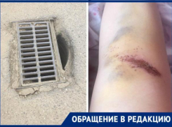 Краснодарка едва не сломала ногу, провалившись в канализационный люк