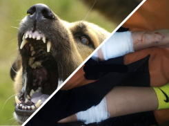 Прокуратура проверяет факт нападения собак на девочку в Краснодаре