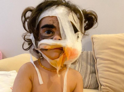  Мама девочки с «маской Бэтмена» собирает деньги, чтобы вернуться в Краснодар