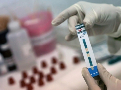 Краснодарцев бесплатно протестируют на ВИЧ 