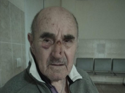 Дедушка в больнице: девочка с семьей сбежала после ДТП с электросамокатом в Краснодаре