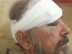 Инвалида, избитого полицейским на Кубани за отказ надеть маску, наказали за неповиновение 
