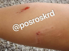 Свора бездомных собак напала на ребенка в Краснодаре 