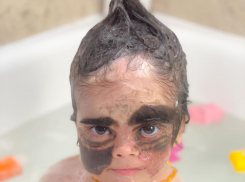 Мама маленькой американки с маской Бэтмена показала фото дочери после операции