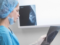 Система последнего поколения для лечения рака появилась в Краснодаре