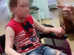 Подросток выстрелил в лицо девочке в Сочи