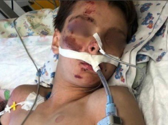 Установлена личность подростка, найденного в бессознательном состоянии в центре Краснодара 