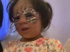 Она уродлива как монстр: травля маленькой американки с лицом Бэтмена в социальных сетях