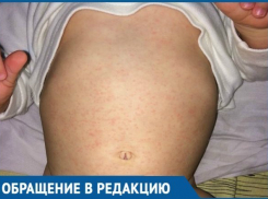  «Даже не знаю, куда вас определить», - жительница Приморско-Ахтарска пожаловалась на местную больницу 
