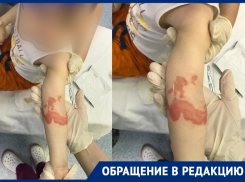Ожог второй степени: кастрюлю с кипящим супом опрокинул на себя малыш в детском саду Краснодара