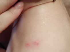 Жители Краснодарского края собирают клопов мешками