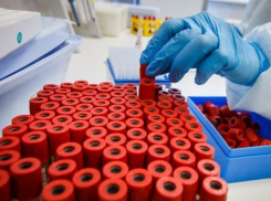  В Краснодаре можно бесплатно узнать свой ВИЧ-статус 