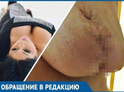 «Он отрезал грудь и зашил ее, как труп в морге», - жительница Кубани об ошибке онколога