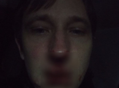 Депутата районного Совета в Ейске избили «прокурор» и «помощник судьи» за просьбу сделать музыку потише 