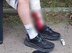 Нападение бездомной собаки на 11-летнего ребенка в Краснодаре заинтересовало Бастрыкина