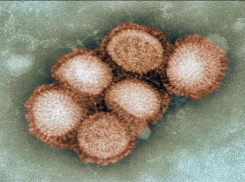 Кубань окружают регионы с повышенным эпидпорогом свиного гриппа