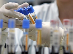 Жителям Сочи предлагают сдать бесплатный тест на ВИЧ