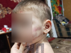 Многодетная мать и отчим избили 3-летнего малыша на Кубани 