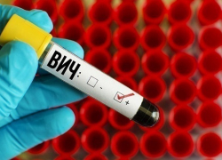 ВИЧ-инфицированных на Кубани в два раза меньше, чем в других регионах России