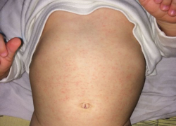  В больнице Приморско-Ахтарска ответили на обвинение женщины, лежащей с маленьким ребенком 