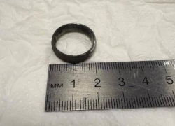 Врачи извлекли кольцо из желудка 11-летнего ребенка на Кубани