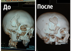 Кубанские нейрохирурги совершили чудо в канун Нового года и вернули к жизни ребенка