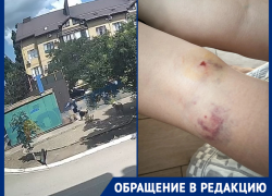 «Страшно ходить во дворе»: стая собак нападает на детей в поселке Краснодара