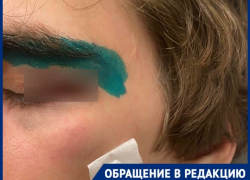 «Ударил подростка в глаз и пробил веко»: потасовка в Краснодаре закончилась больничным и уголовным делом