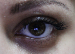 Бесплатно провериться на глаукому может любой житель Краснодарского края 6 марта