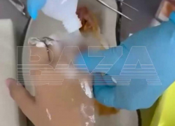 В Краснодаре 9-летний мальчик лишится пальца из-за безрассудности старшеклассницы 