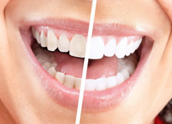  Как часто нужно посещать стоматолога краснодарцам? 