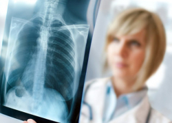 "Мы Вас вылечим": к принудительному оздоровлению приговорили краснодарца, самовольно покинувшего стационар