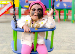 Мама маленького «Бэтмена», которая проходит лечение в Краснодаре, поделилась успехами дочери