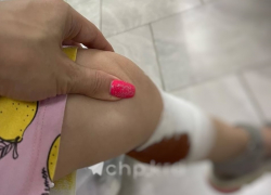 Стая бродячих собак напала на двухлетнюю девочку в Краснодаре